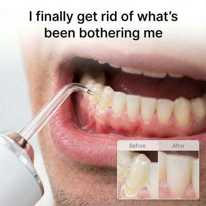 HydroDent Advanced Flosser